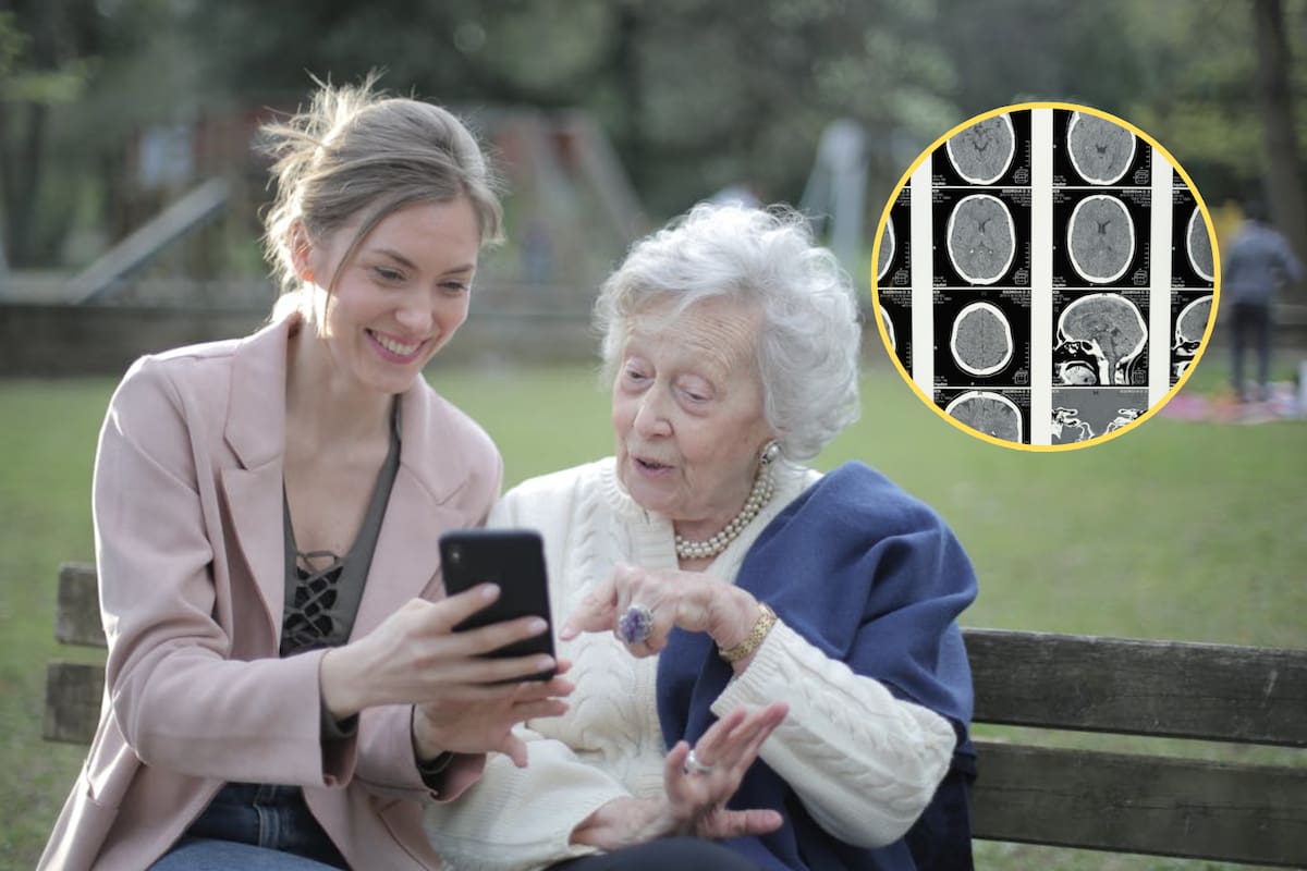 Científicos logran reducir el daño cerebral del Alzheimer al eliminar una proteína clave y observan mejoras en memoria