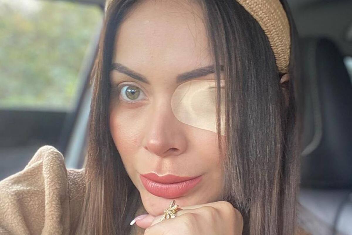 Modelo colombiana casi se queda ciega por usar producto para pestañas
