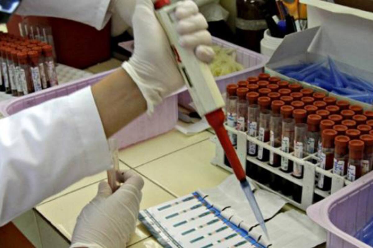 Lidera BC casos de hepatitis C