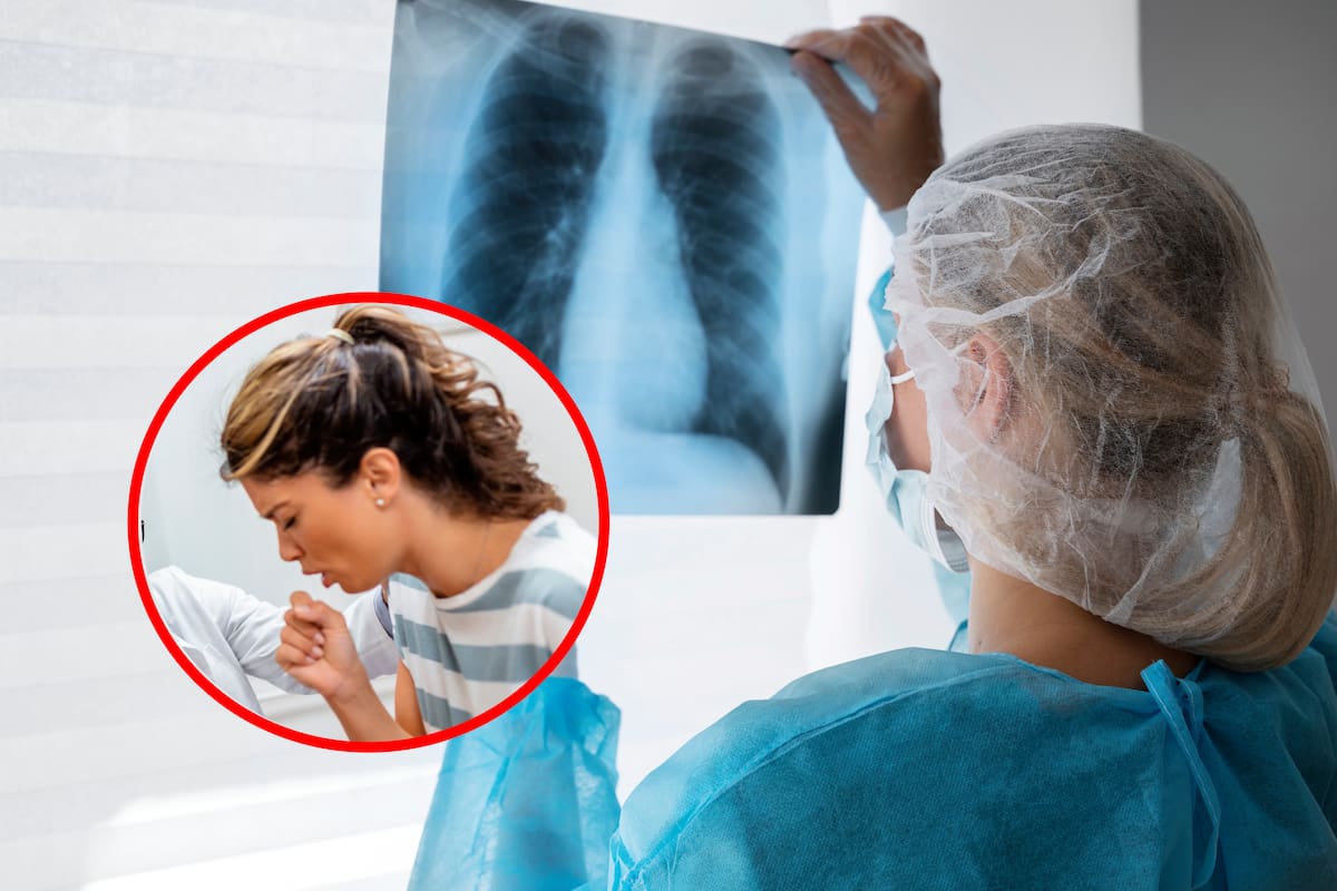 Aumentan 27% los casos de neumonía en BC