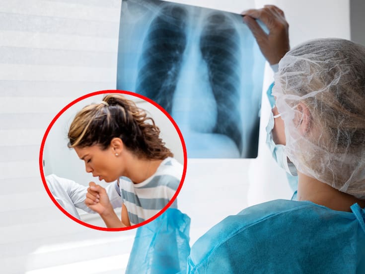 Aumentan 27% los casos de neumonía en BC