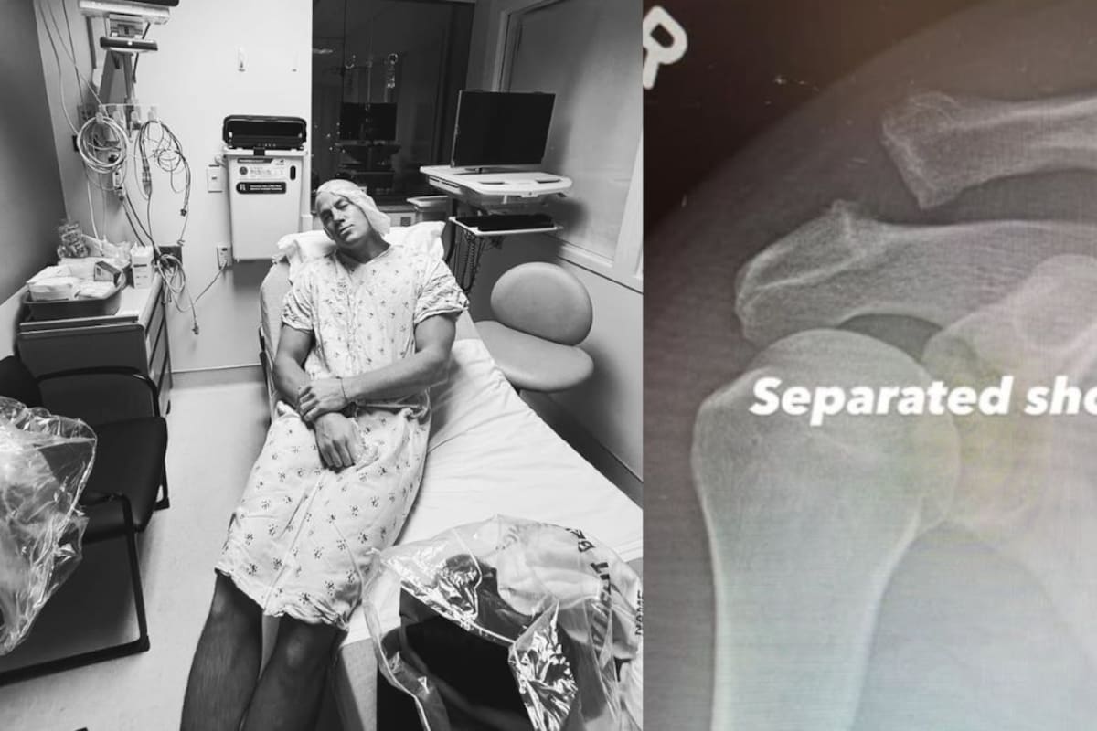 Channing Tatum es operado del hombro: el actor confirma lesión grave y comparte radiografías desde el hospital