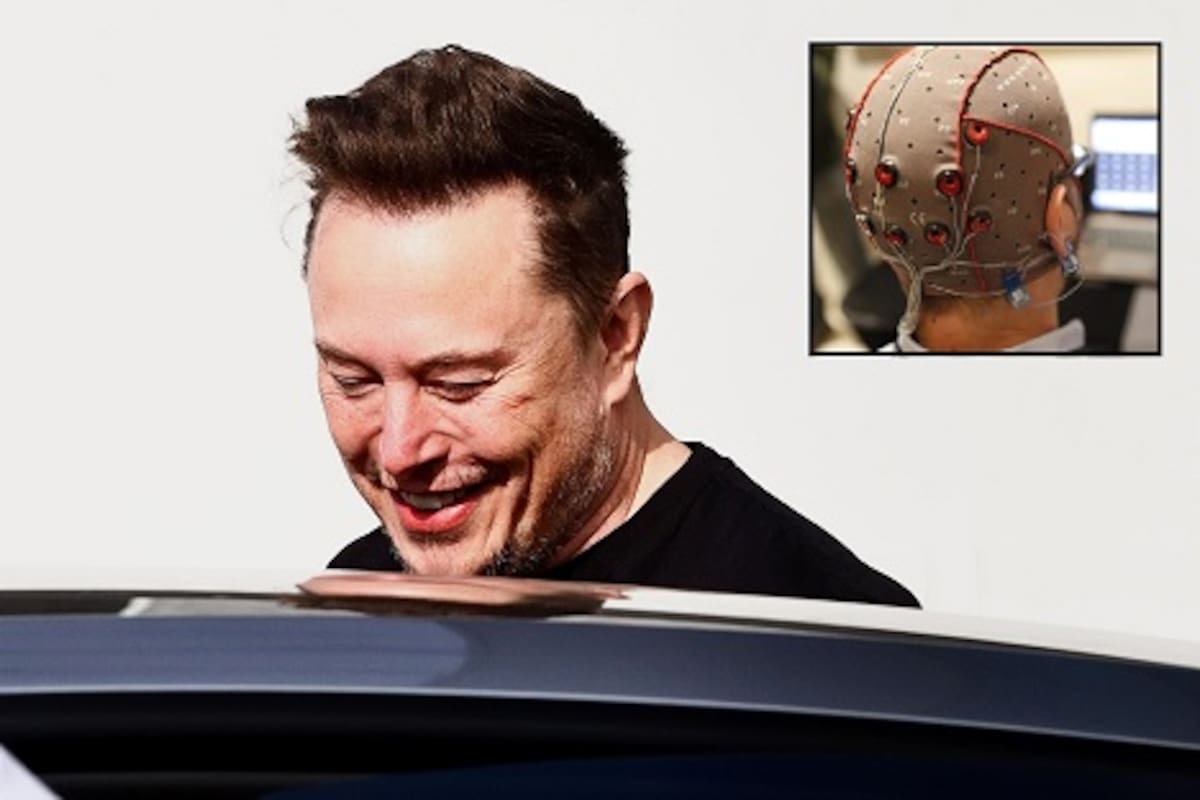 Elon Musk dice que Neuralink ya está lista para hacer segundo implante de chip cerebral