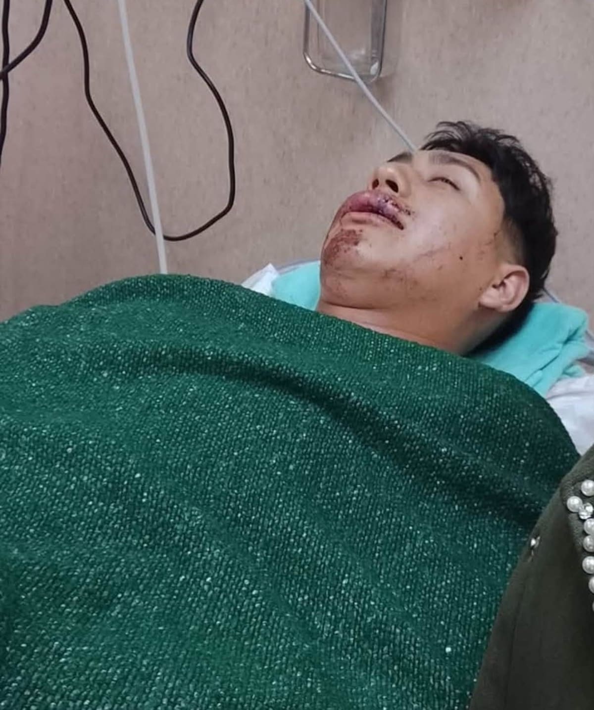 Familiares de Jovani Ojeda Sandoval piden el apoyo de la ciudadanía para reunir 15 donadores de sangre antes de las cirugías que requiere tras el accidente.
Foto: Cortesía.