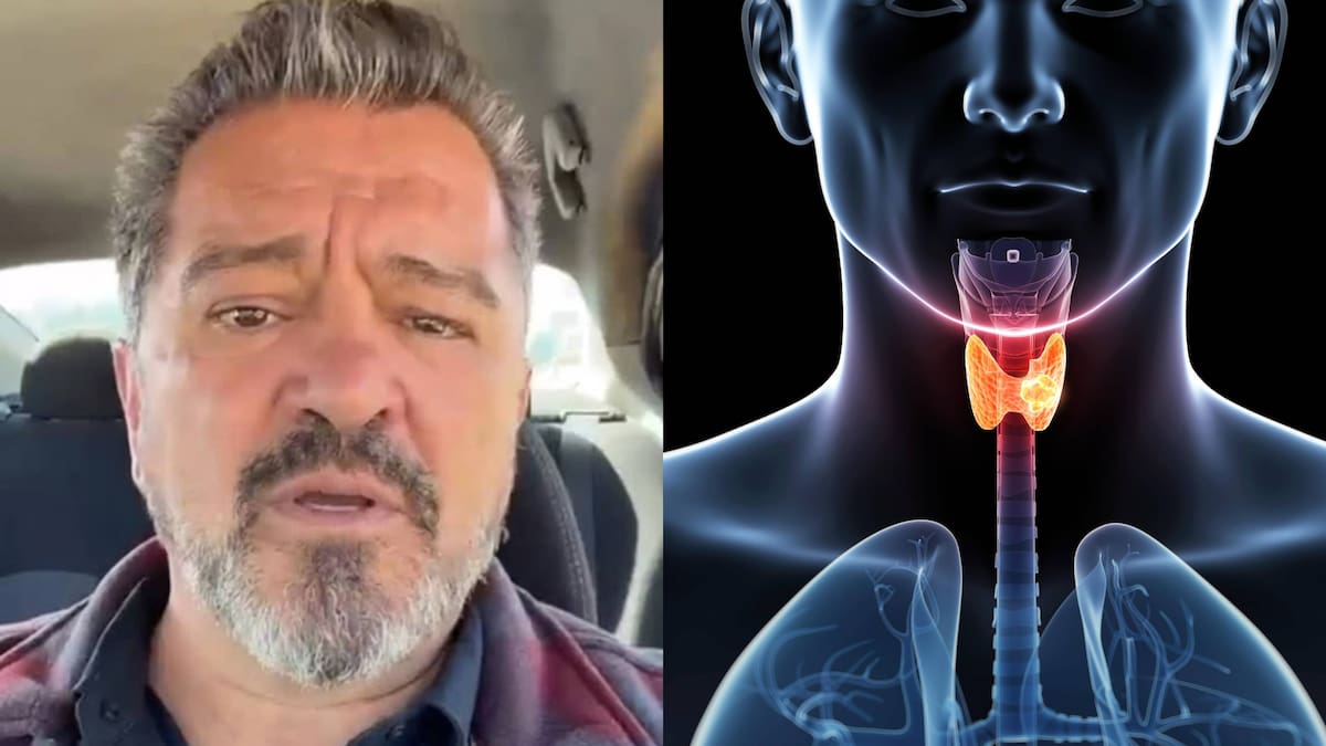 Carlos Hermosillo desmintió que tuviera cáncer tras la viralización de una “fake news”, aunque recordó un episodio de salud que en su momento generó alarma por un problema en la tiroides