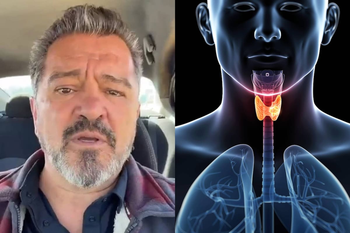 Carlos Hermosillo desmintió que tuviera cáncer tras la viralización de una “fake news”, aunque recordó un episodio de salud que en su momento generó alarma por un problema en la tiroides