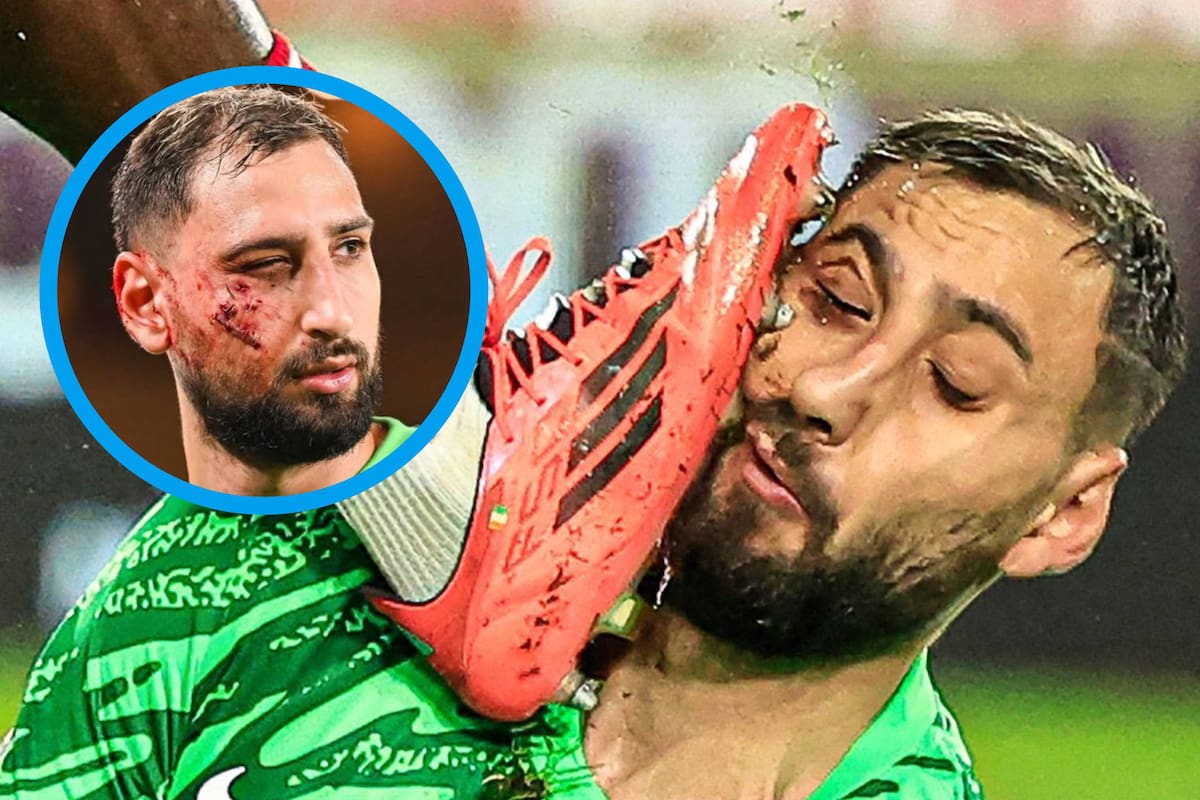 VIDEO: Gigio Donnarumma, del PSG, sufre violento pisotón en la cara