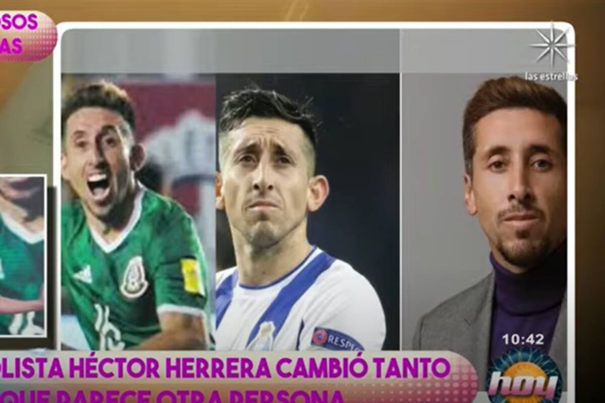 Famosos adictos a las cirugías estéticas