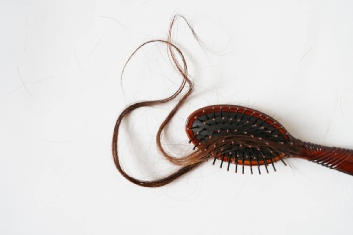 ¿Cuáles son los detonantes de la alopecia femenina?