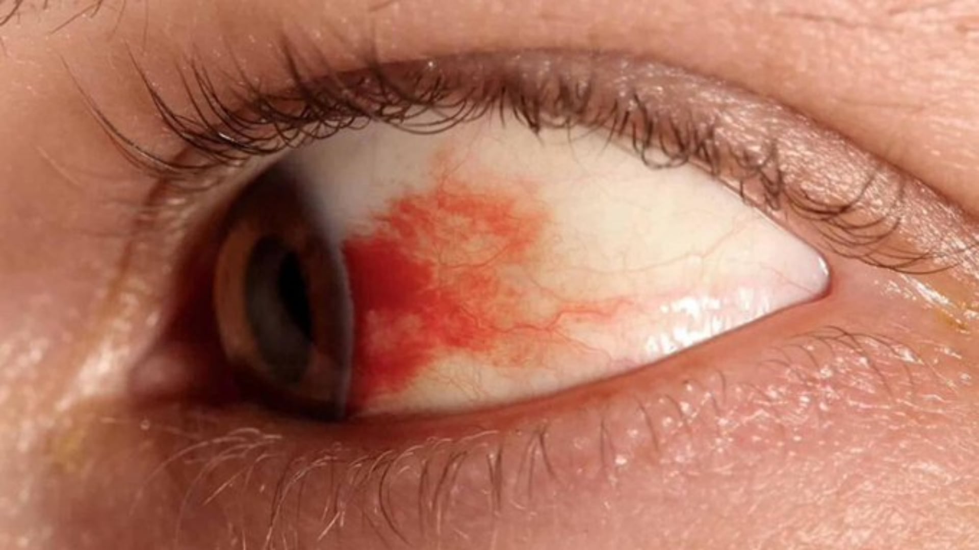 Investigadores de la UNAM desarrollan gotas oftálmicas que podrían reemplazar inyecciones en el tratamiento de la retinopatía diabética y prevenir la ceguera. /El Universal