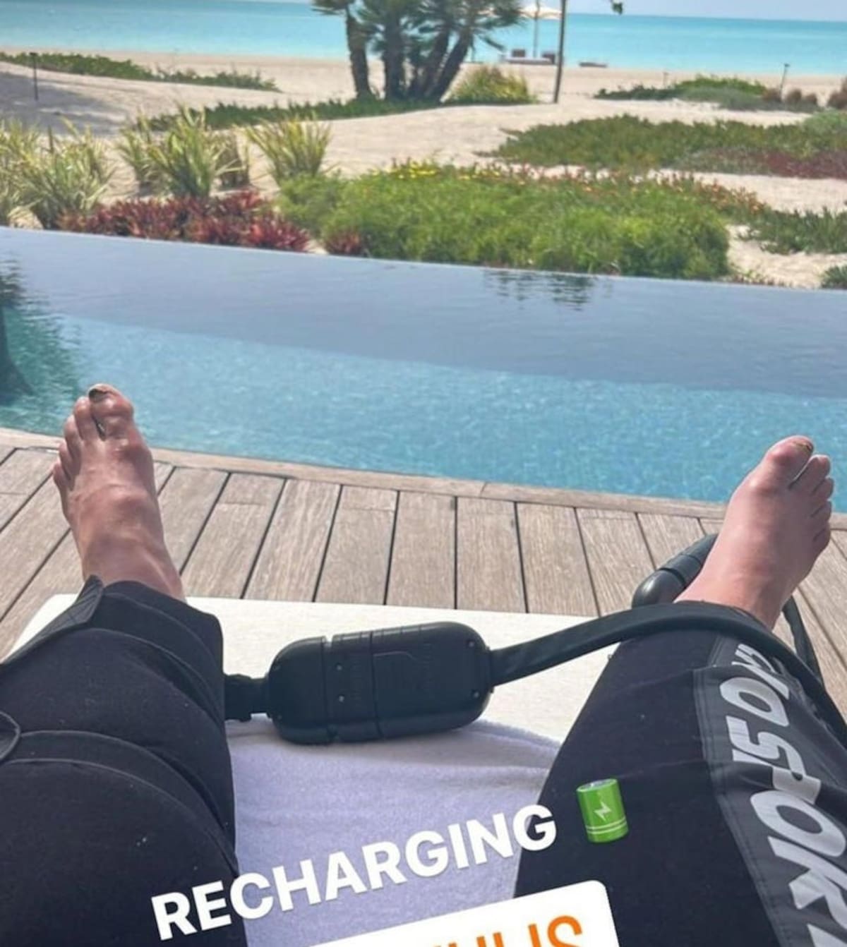Cristiano Ronaldo desató varios comentarios y sentimientos encontrados con una foto de sus pies que lucen hinchados y golpeados.