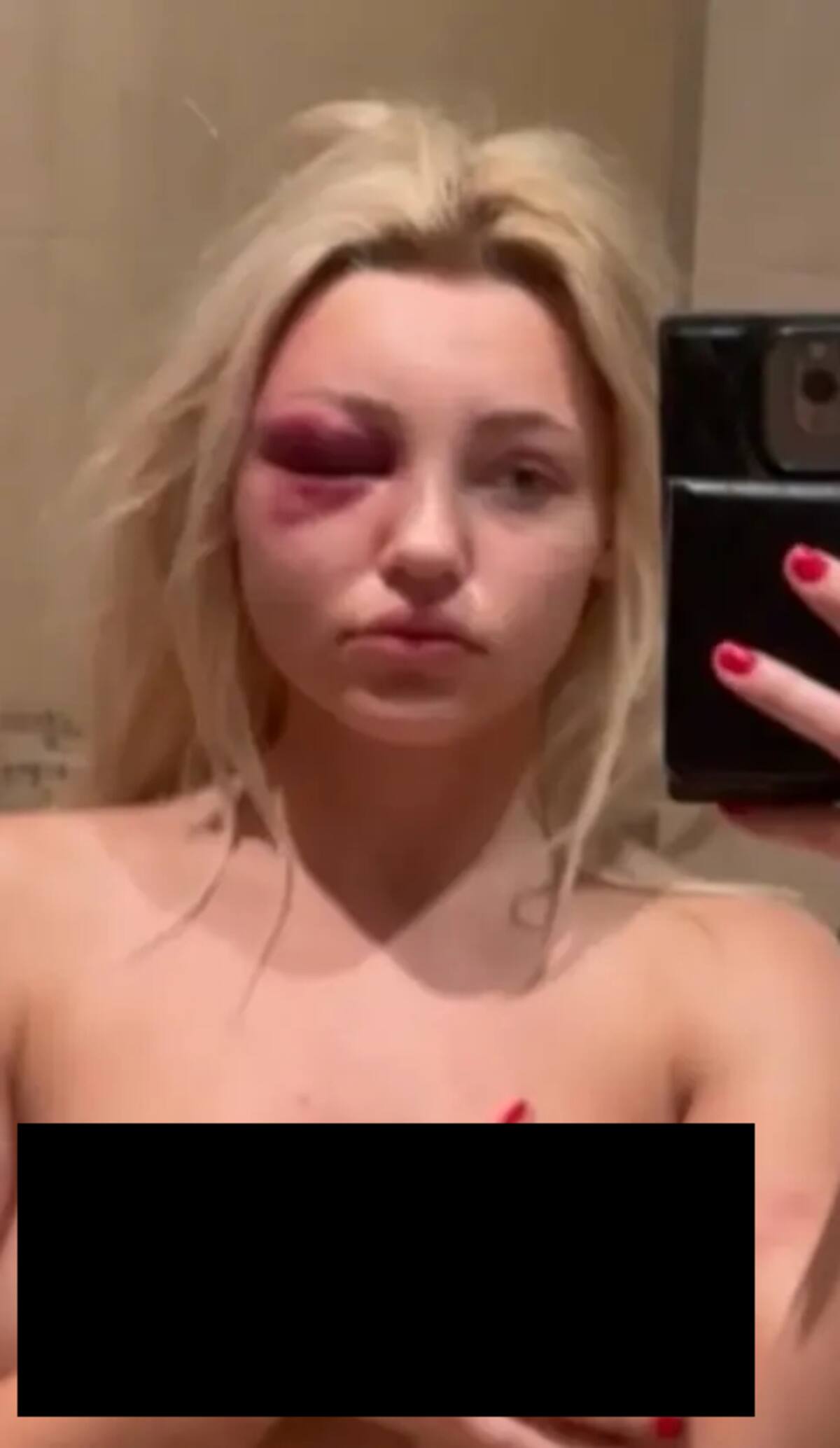 Cirujano plástico de Nueva York acusado de convertir a modelo en 'esclava sexual'. FOTO: NY Post
