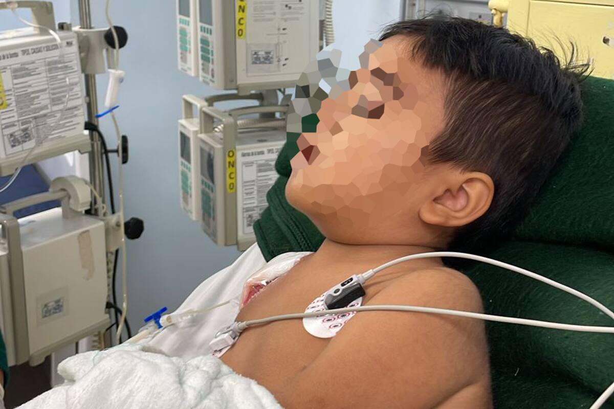 Requiere Keigo donadores de plaquetas