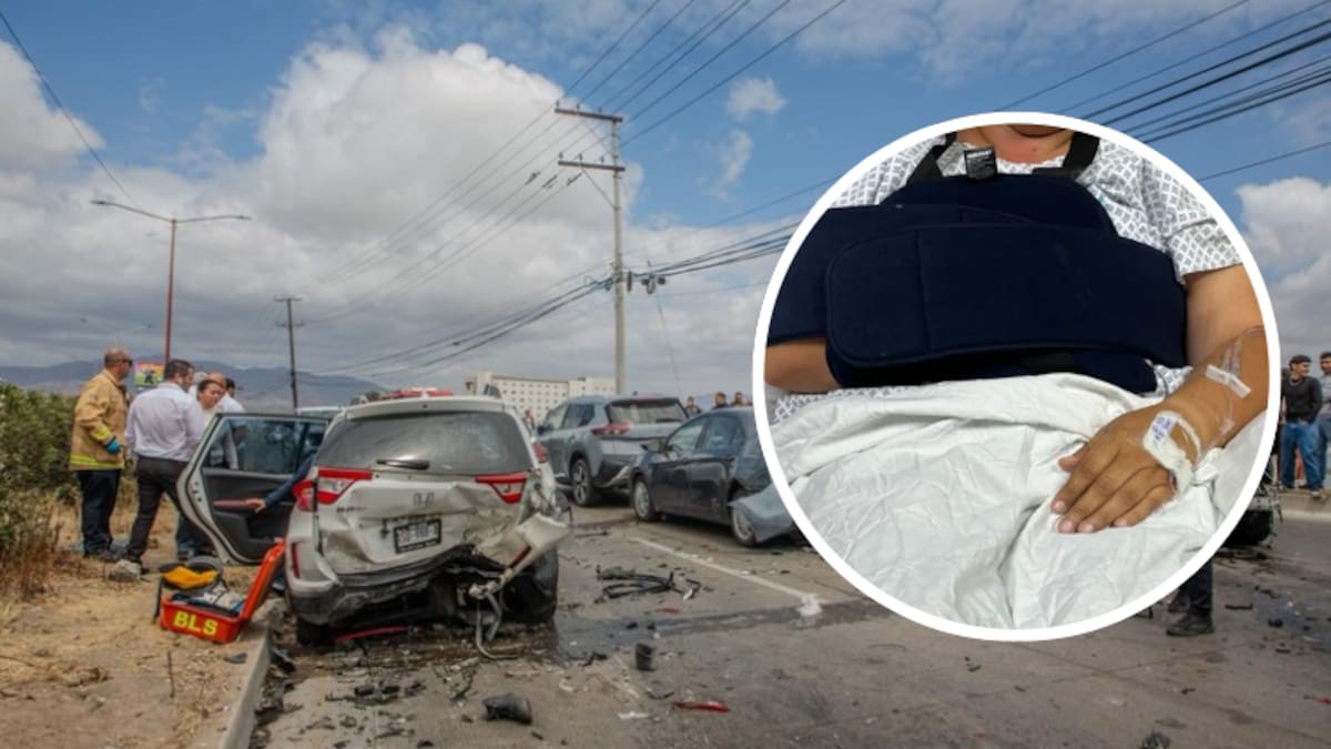 Víctima de choque frente a UABC en Tijuana sigue hospitalizada; perdió su vehículo y enfrenta gastos médicos