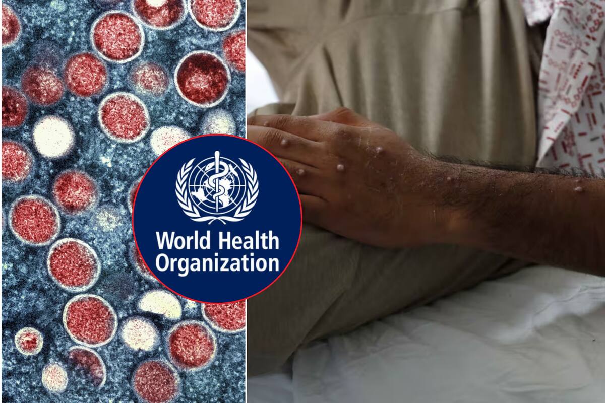 Viruela del Mono: OMS declara emergencia sanitaria internacional por Mpox, ¿qué significa y dónde hay aumento de propagación?