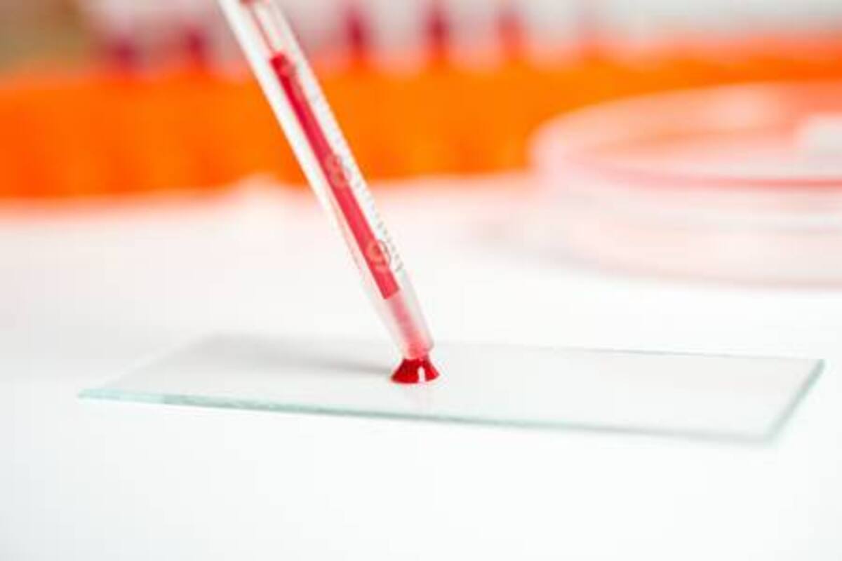 Inventa estudiante dispositivo que busca medir niveles de glucosa, colesterol y triglicéridos