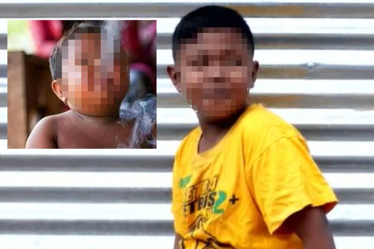 Así luce y esto pasó con el niño fumaba 40 cigarros diarios