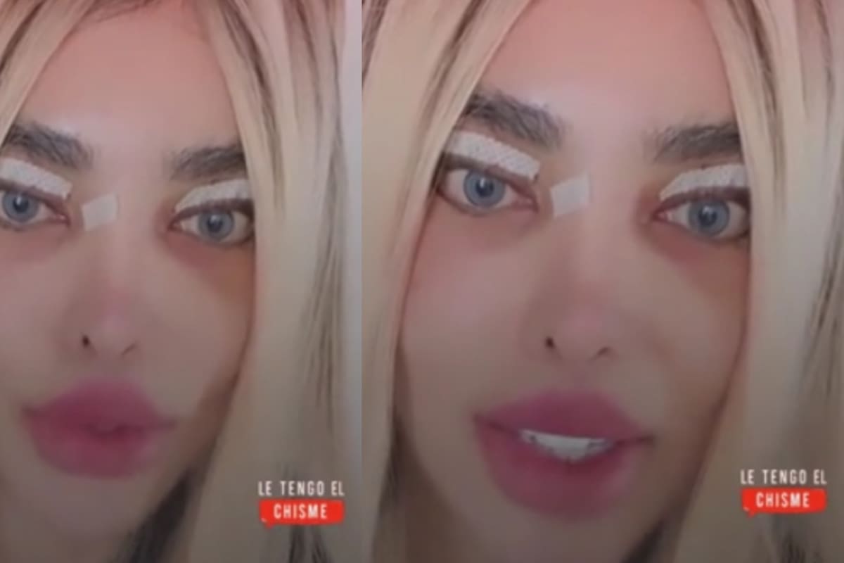 “Barbie colombiana” revela que, tras una cirugía, ya no puede cerrar los ojos y sorprende a sus seguidores