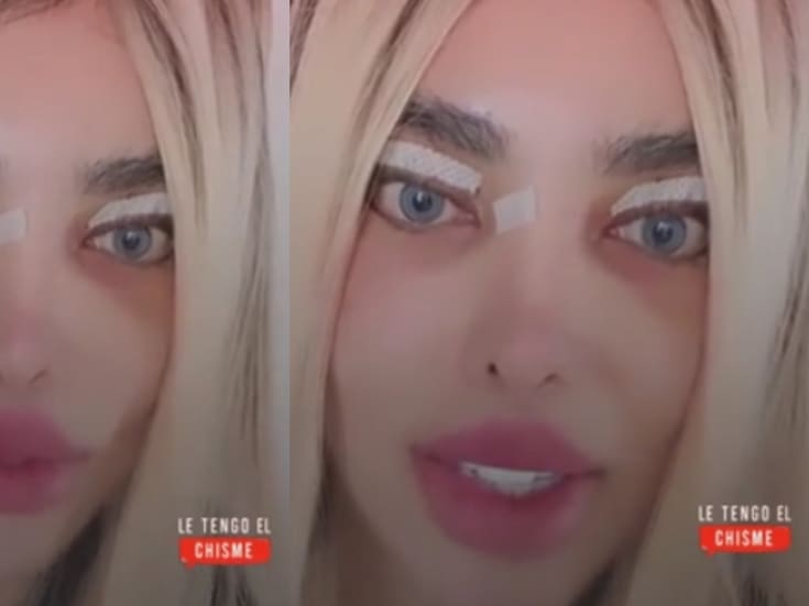 “Barbie colombiana” revela que, tras una cirugía, ya no puede cerrar los ojos y sorprende a sus seguidores