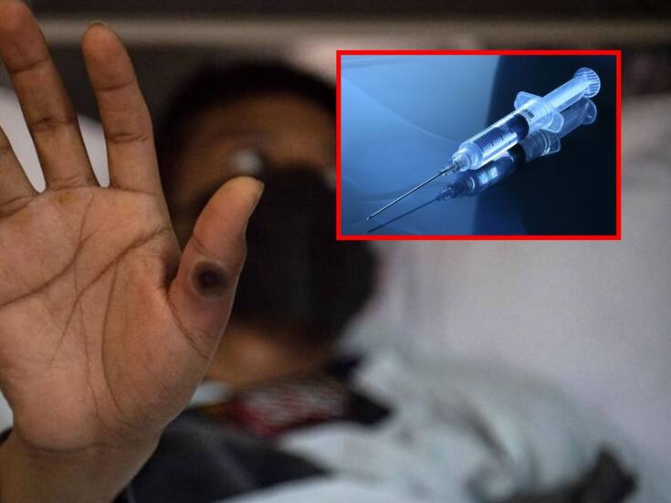 No hay necesidad de caer en pánico por viruela del mono: Infectólogo en Sonora