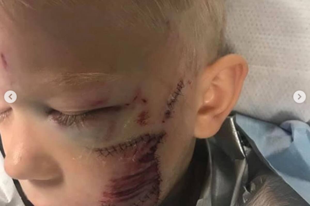 “Si alguien tenía que morir, debía ser yo”: niño salvó a su hermana de un ataque de perro; CMB lo reconoce como Campeón Honorario