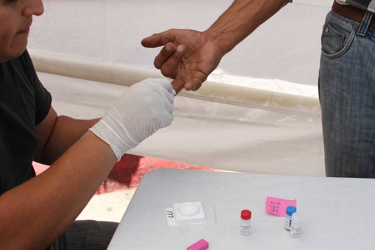 Detectan dos casos de VIH y cuatro de Sífilis en ‘Pruebatón’