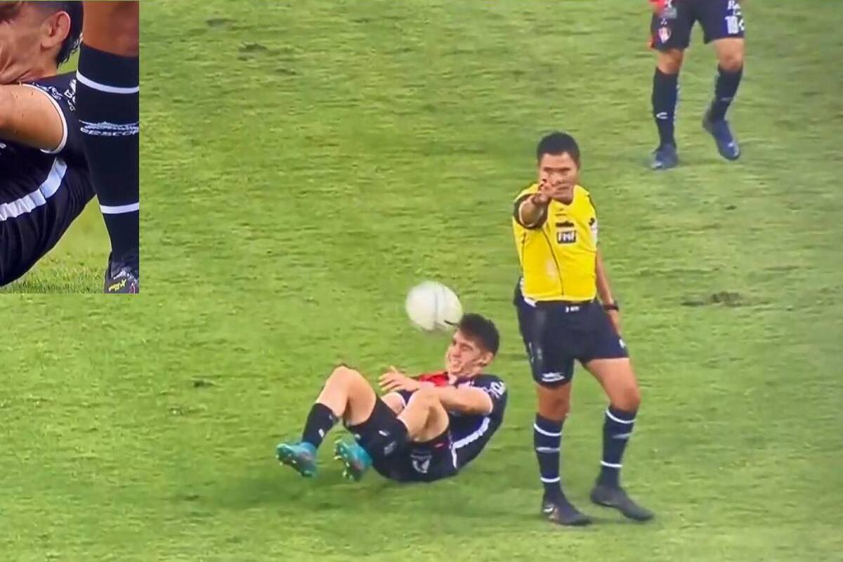 ¡Lo reiniciaron! Futbolista del Atlas recibe balonazo en la cara justo cuando estaba lesionado (VIDEO VIRAL)
