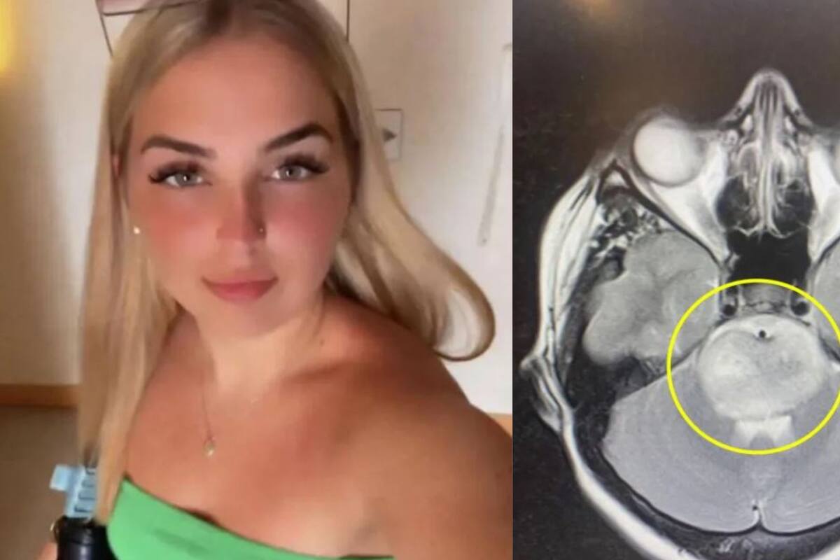 “Me restan 12 meses de vida”: Joven confunde una ‘cruda’ con enfermedad terminal