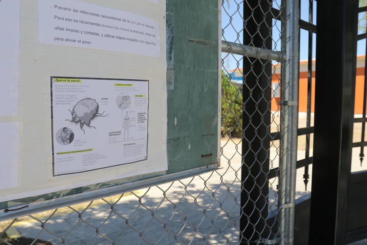 Detectan dos casos de sarna en CAME 16