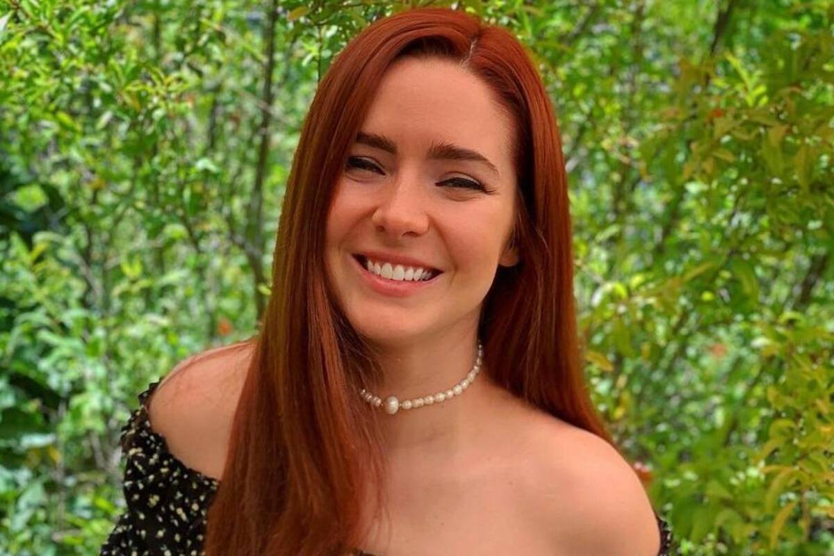 Ariadne Díaz muestra las manchas en el rostro que le provocó un tratamiento estético
