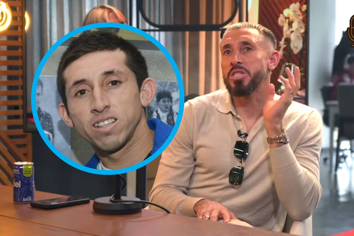 Héctor Herrera explica por qué se sometió a cirugías estéticas