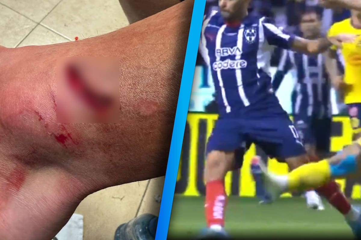 ‘Tecatito’ Corona sufre espeluznante herida provocada por jugador del América