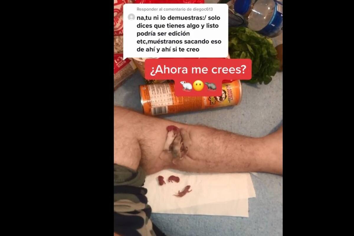 VIDEO: Joven "asegura" que le "salen" ratones de su pierna