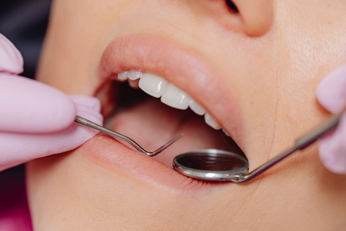 Tratar a tiempo una infección dental podría ayudar a controlar el azúcar en sangre y reducir riesgos cardiovasculares, según investigaciones