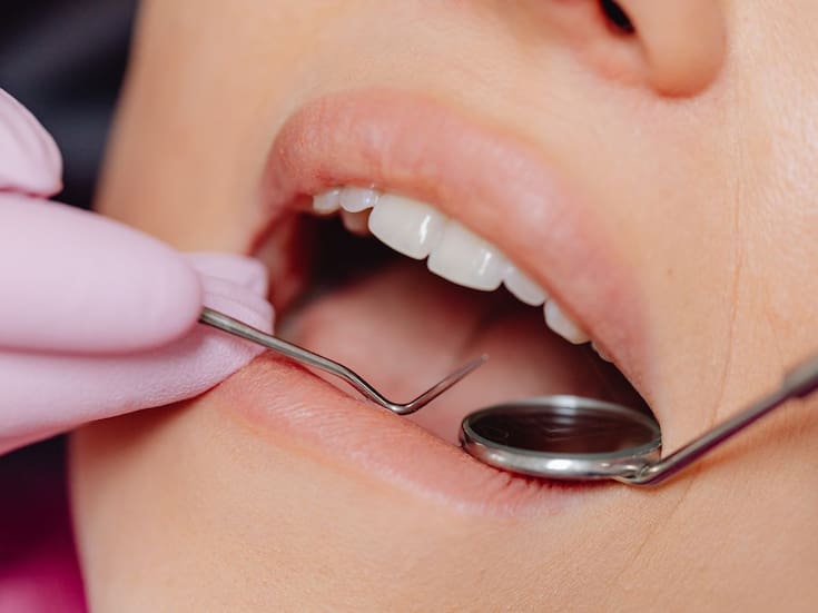 Tratar a tiempo una infección dental podría ayudar a controlar el azúcar en sangre y reducir riesgos cardiovasculares, según investigaciones