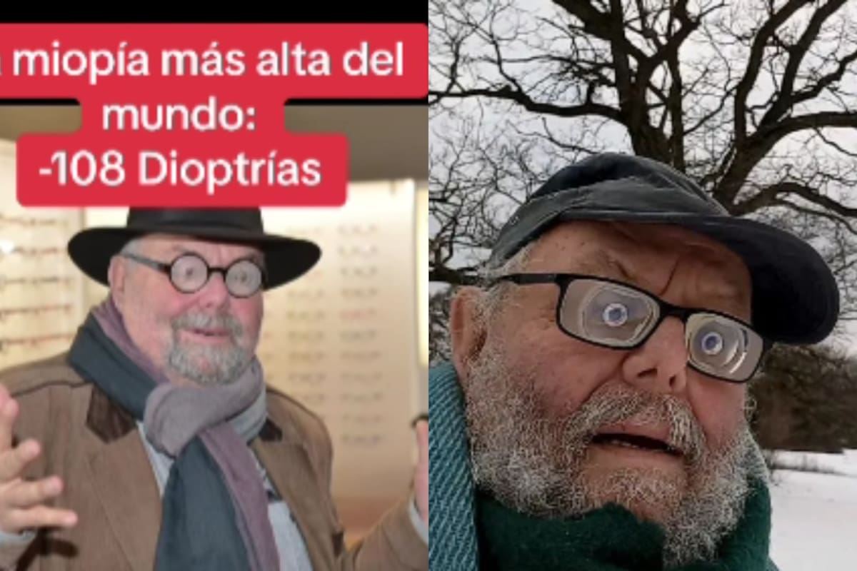 “Tiene -108 dioptrías”: este es el hombre con la miopía más alta del mundo