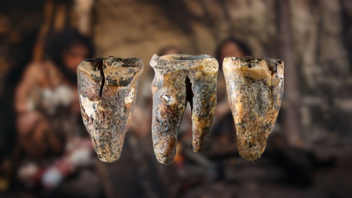 Un diente de 59 mil años hallado en Siberia mostró marcas de una posible perforación hecha con piedra y abrió la hipótesis de que los neandertales aliviaban caries con una intervención dental deliberada mucho antes de lo que se pensaba en la historia humana