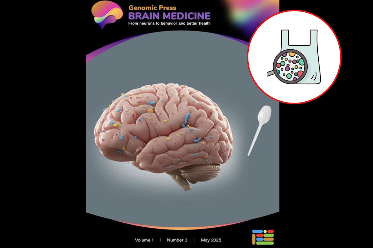 Tu cerebro podría contener una cucharada de microplásticos, según estudio