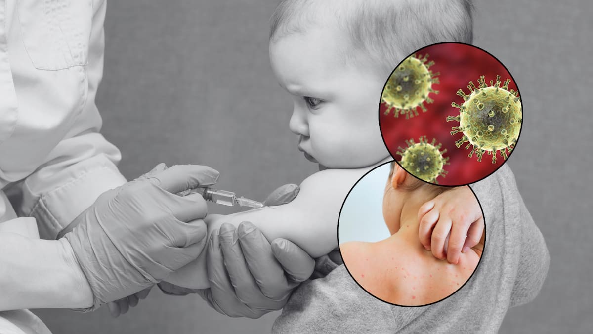 En más del 75% de los condados y jurisdicciones de Estados Unidos que proporcionaron datos desde 2019, ha habido una tendencia a la baja en la vacunación contra la difteria, el tétanos y la tos ferina (DTaP), vacuna que se administra por primera vez a los bebés a los 2 meses. Foto: Canvas