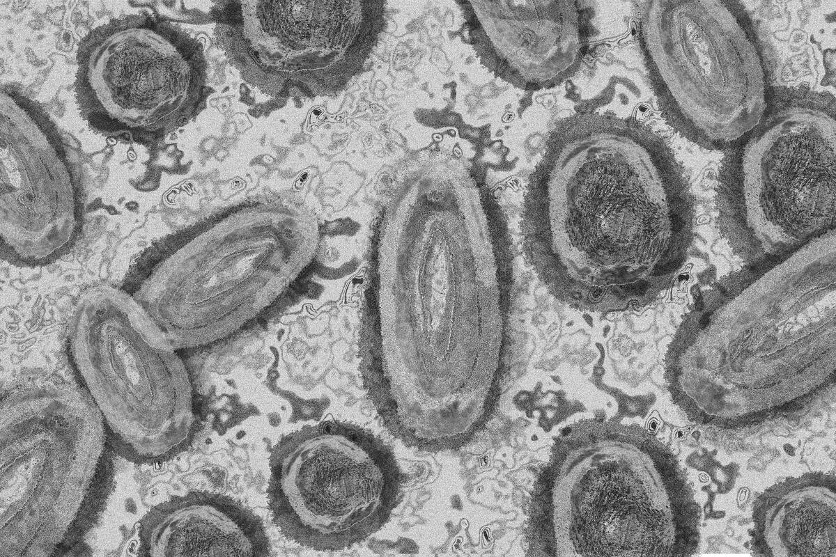 México reporta dos mil 901 casos de viruela símica