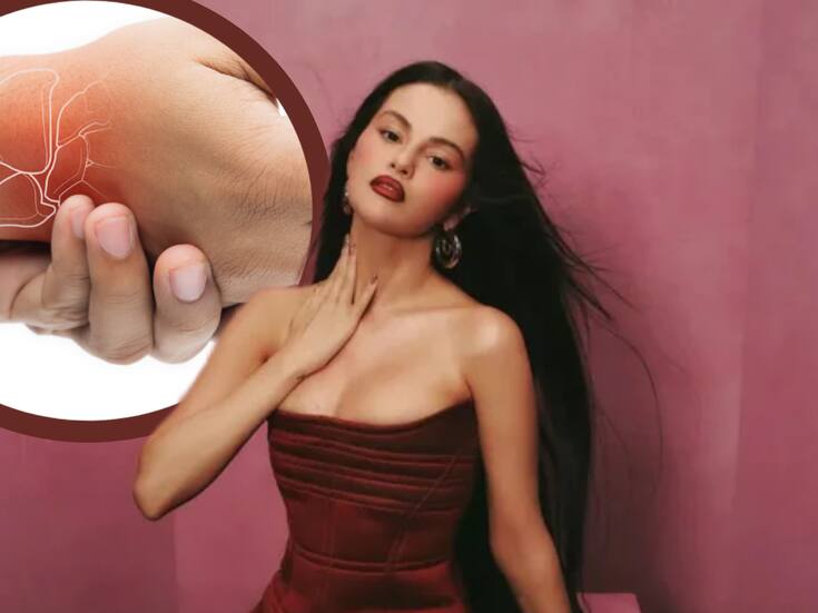 Selena Gomez revela el nuevo diagnóstico que enfrenta como consecuencia del lupus