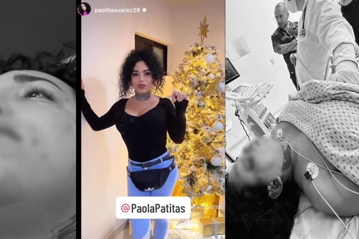 Paola Suárez a punto de perder su ojo y con dos costillas rotas tras ser golpeada por su prometido