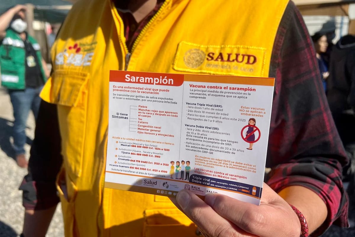 BC acumula 5 casos de sarampión en el inicio del 2026