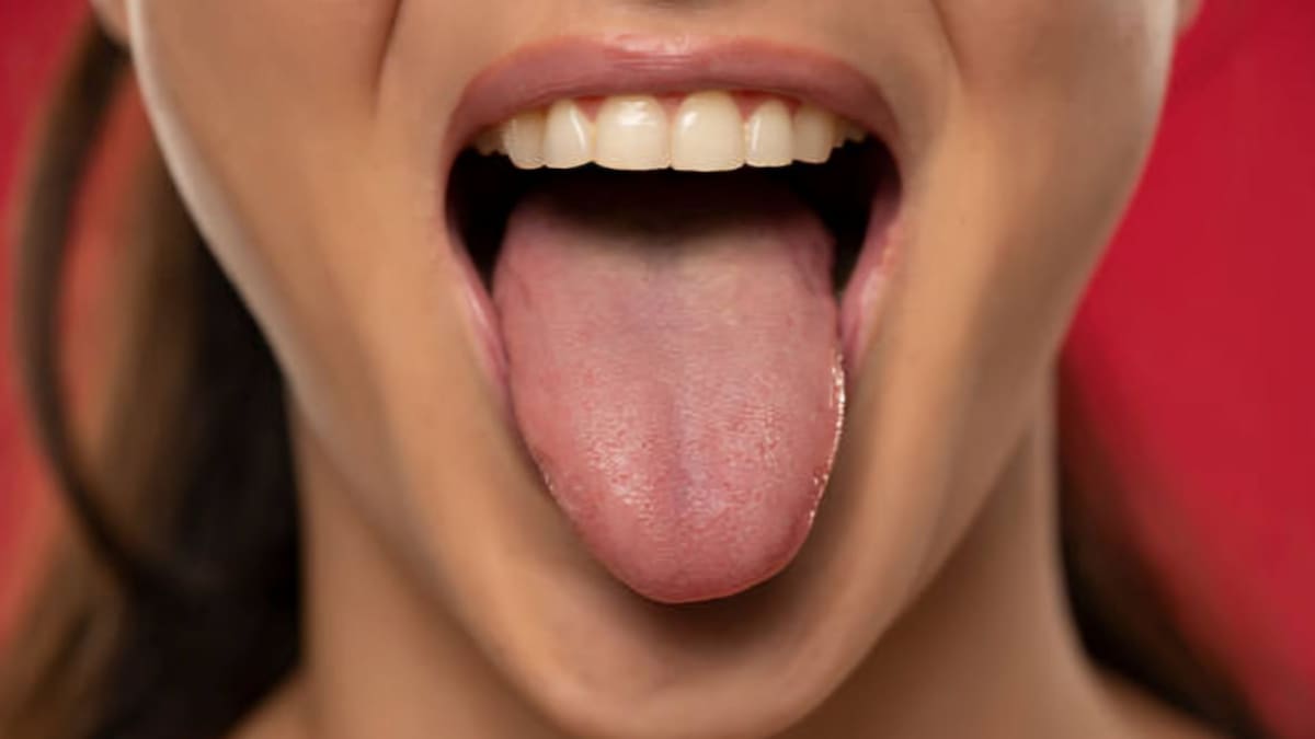¿Por qué aparece la lengua amarilla y qué puedes hacer al respecto? | Foto: Especial (canva)