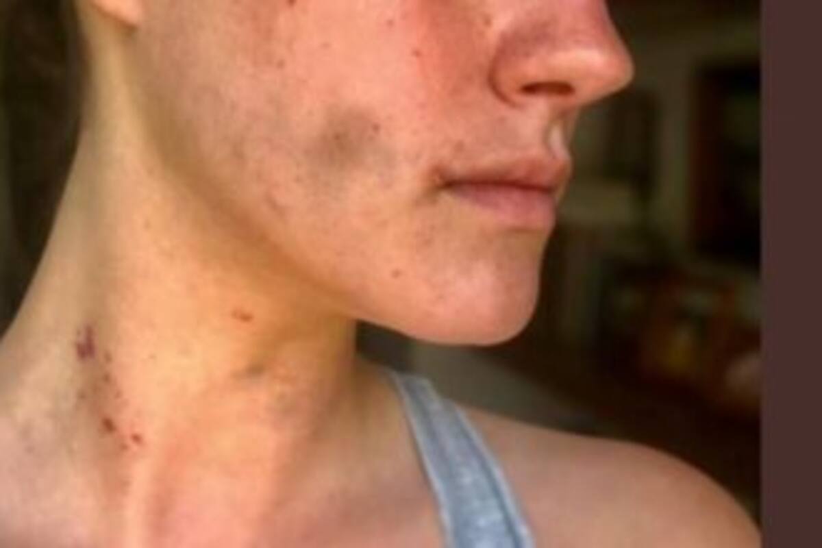 Acusan a Alexandro Struck Azcárraga, nieto del dueño de Grupo Fórmula, de golpear a mujer