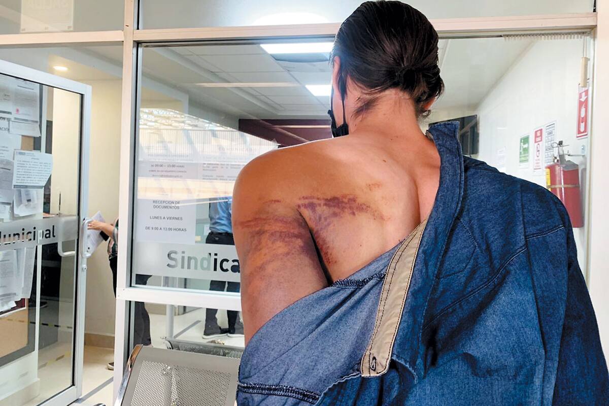 Denuncian presunta agresión de policías ante la Sindicatura