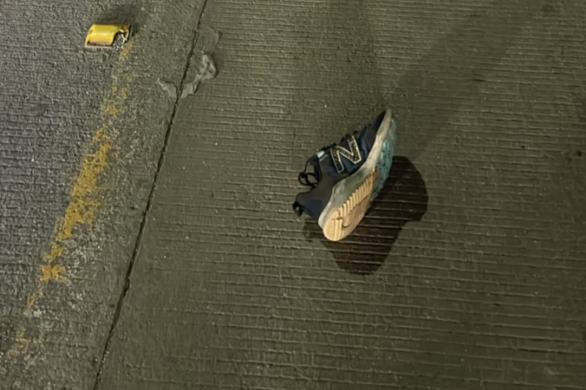 Mujer resulta gravemente herida en atropellamiento