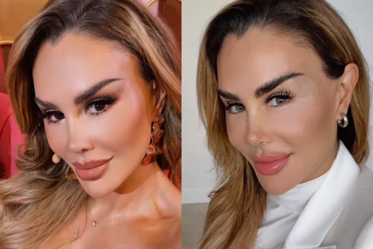 Ninel Conde estrena nuevo color de ojos, pero con riesgos de perder la vista