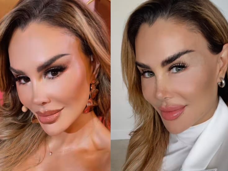 Ninel Conde estrena nuevo color de ojos, pero con riesgos de perder la vista