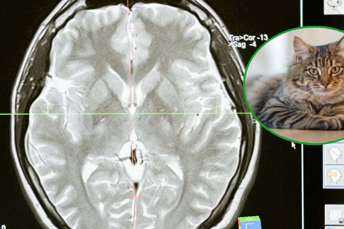 Parásitos cerebrales en heces de los gatos podrían utilizarse para tratar el Alzheimer y el Parkinson, según estudio